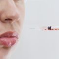 Psychische Gesundheit und Schönheitsoperationen: Wann wird der Wunsch zur Gefahr?
