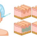 Die Entwicklung der ästhetischen Nasenchirurgie in Deutschland: Geschichte, Innovationen und Trends