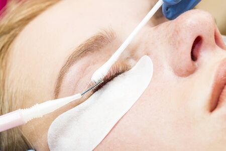 Vergleich: Lidstraffung in Deutschland vs. Blepharoplastik im Ausland – Chancen, Risiken, kulturelle Unterschiede