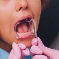 Rechtliche Rahmenbedingungen und Patientenrechte bei Schamlippenkorrektur in Deutschland