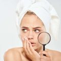 Die Ursachen von Pigmentflecken und Melasma: Wissenschaftliche Einblicke und kulturelle Besonderheiten in Deutschland