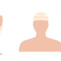Heimpflege nach dem chemischen Peeling: Tipps für die optimale Regeneration und Ergebnisse