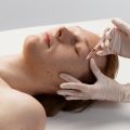 Laserbehandlungen für Männerhaut: Möglichkeiten und Risiken im deutschen Alltag