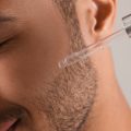 Microneedling: Wie funktioniert die innovative Hautverjüngung?