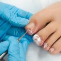 Wissenschaftliche Grundlagen des chemischen Peelings: Wie funktioniert es wirklich?