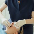 Das erste Mal beim chemischen Peeling: Aufklärung, Angstabbau und Vorbereitung