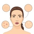Vaginalverjüngung durch Laser versus operative Eingriffe: Methoden, Wirkungsweisen und Unterschiede