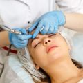 Narbenreduktion nach Akne: Möglichkeiten in der dermatologischen Kosmetik