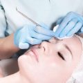 Erfahrungsberichte: Deutsche Patientinnen und Patienten berichten von ihrem Facelift