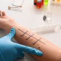 Microneedling als Teil einer ganzheitlichen Hautpflegeroutine