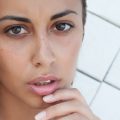 Chemisches Peeling bei Akne: Indikationen, Wirksamkeit und langfristige Ergebnisse