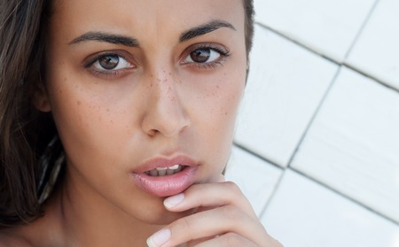 Chemisches Peeling bei Akne: Indikationen, Wirksamkeit und langfristige Ergebnisse