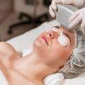 Kombinationsbehandlungen: PRP mit Microneedling, Laser und Hyaluron – Was ist möglich?