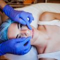 Faltenbehandlung mit Laser und ihre Rolle in der anti-aging Medizin