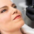 Mesotherapie mit Hyaluronsäure: Wirkung, Vorteile und Risiken