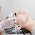 Microneedling im Vergleich zu anderen Methoden der Hautverjüngung