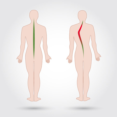 Erbium:YAG-Laser: Sanftere Alternative